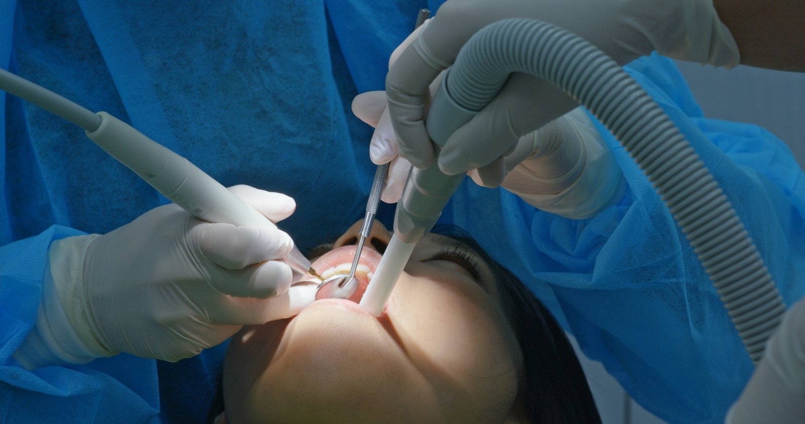 Woman under dental check up in clinic